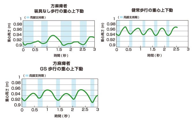 歩きやすさを求めて まったく新しい短下肢装具の開発 | NEDO | 実用化ドキュメント