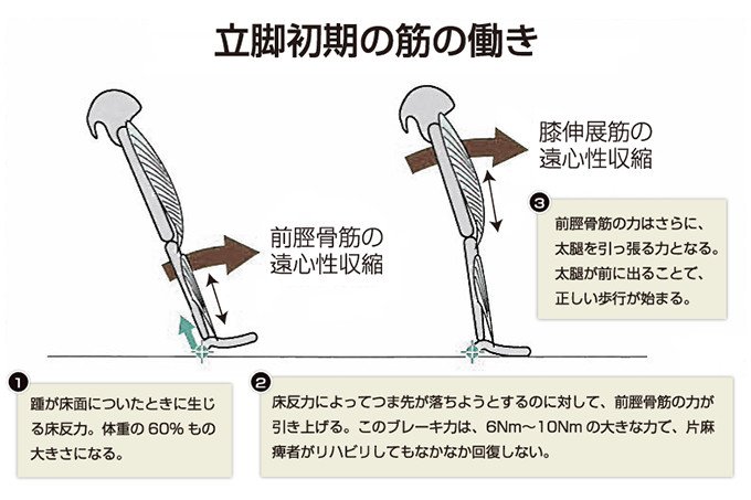 歩きやすさを求めて まったく新しい短下肢装具の開発 | NEDO | 実用化ドキュメント