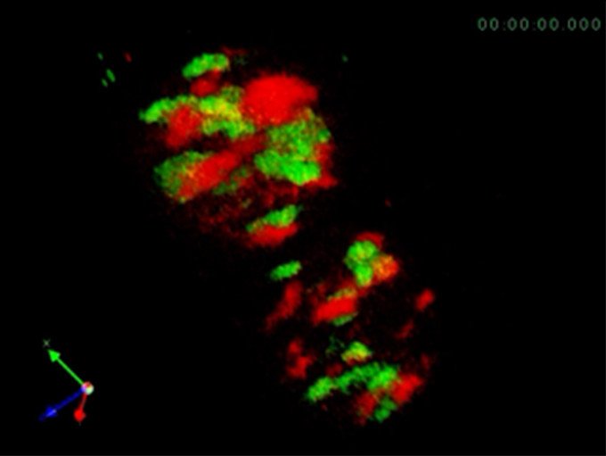 【極美品】角結膜がみえてくる生体共焦点顕微鏡検査 IN VIVO BIOPSY ようこそ！