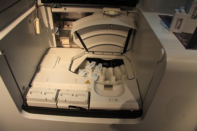 中毒研究 世界初、糖鎖の変化を測定して肝臓の線維化進行度を判定 | NEDO | 実用